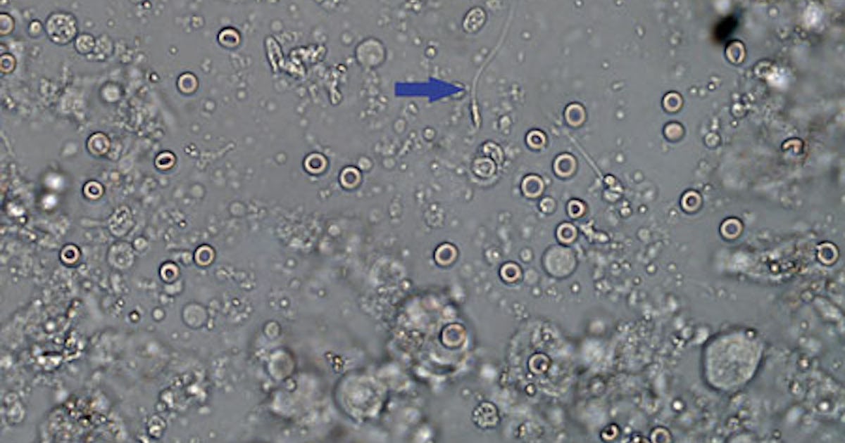 Qamoqxonada eshagi bilan sikilgan yigitni onlayn tomosha qiling Jinsiy aloqadan keyin tiklanishim uchun uzoq vaqt kerak boladi.